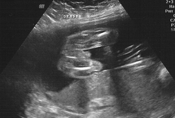 21w Boy Shot.jpg