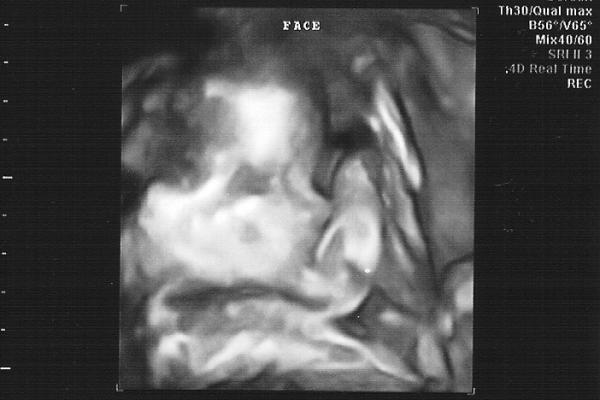 21w Profile.jpg